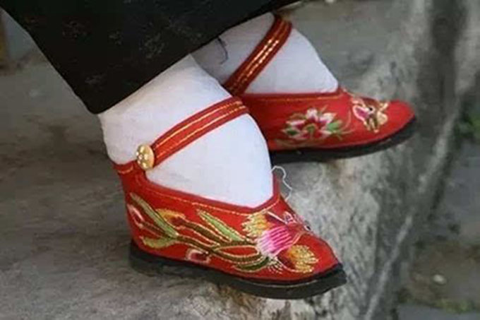 你知道"穿小鞋"的由来吗?__中华人